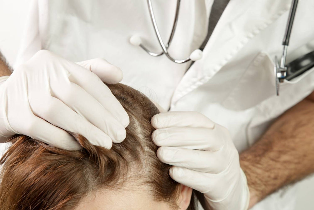 Scalp Psoriasis: Causes, Symptoms, and Treatment