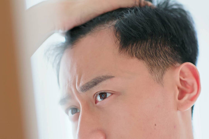 Hair Loss On One Side of the Head – Causes & Treatments