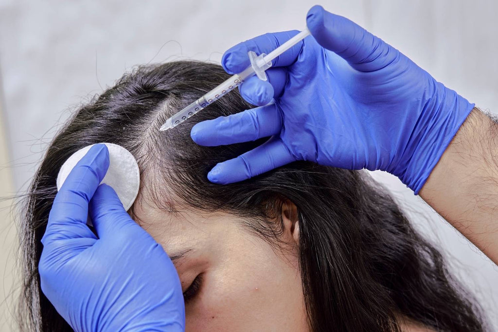 The Top 6 Best Hair Loss Treatments